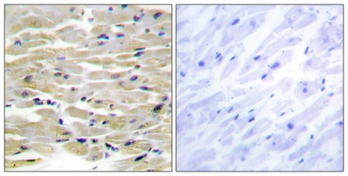 Anti-TENS3 antibody used in IHC (Paraffin sections) (IHC-P). GTX87949