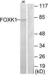 Anti-FOXK1 antibody used in Western Blot (WB). GTX87950
