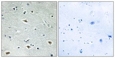 Anti-MTG16 antibody used in IHC (Paraffin sections) (IHC-P). GTX87954