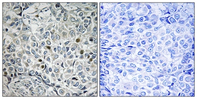 Anti-USP53 antibody used in IHC (Paraffin sections) (IHC-P). GTX87956