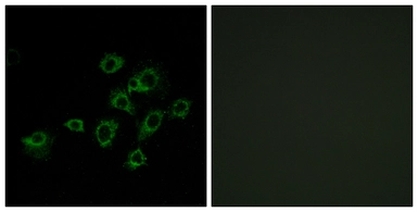 Anti-LILRA1 antibody used in Immunocytochemistry/ Immunofluorescence (ICC/IF). GTX87961