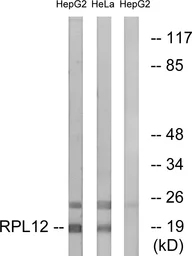 Anti-RPL12 antibody used in Western Blot (WB). GTX87963
