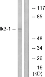 Anti-CABLES1 antibody used in Western Blot (WB). GTX87964