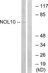Anti-NOL10 antibody used in Western Blot (WB). GTX87965