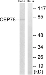 Anti-CEP78 antibody used in Western Blot (WB). GTX87967