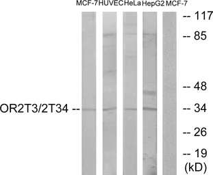 Anti-OR2T3 + OR2T34 antibody used in Western Blot (WB). GTX87968