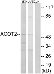 Anti-ACOT2 antibody used in Western Blot (WB). GTX87970