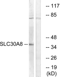 Anti-SLC30A8 antibody used in Western Blot (WB). GTX87971