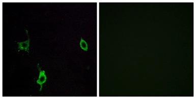 Anti-LAMC3 antibody used in Immunocytochemistry/ Immunofluorescence (ICC/IF). GTX87972