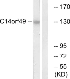 Anti-Nesprin 3 antibody used in Western Blot (WB). GTX87974