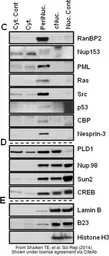 Anti-Nesprin 3 antibody used in Western Blot (WB). GTX87974