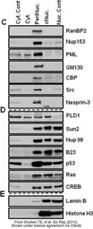 Anti-Nesprin 3 antibody used in Western Blot (WB). GTX87974