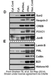 Anti-Nesprin 3 antibody used in Western Blot (WB). GTX87974