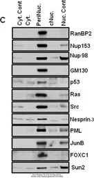 Anti-Nesprin 3 antibody used in Western Blot (WB). GTX87974