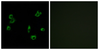 Anti-PEVR1 antibody used in Immunocytochemistry/ Immunofluorescence (ICC/IF). GTX87976