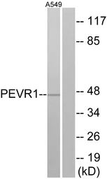 Anti-PEVR1 antibody used in Western Blot (WB). GTX87976