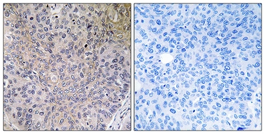 Anti-NDUFS7 antibody used in IHC (Paraffin sections) (IHC-P). GTX87977