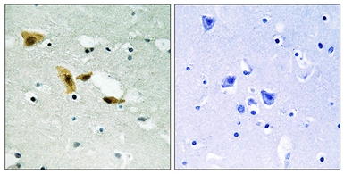 Anti-APLF antibody used in IHC (Paraffin sections) (IHC-P). GTX87979