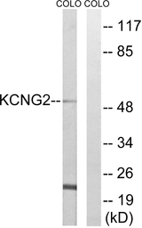 Anti-KCNG2 antibody used in Western Blot (WB). GTX87981