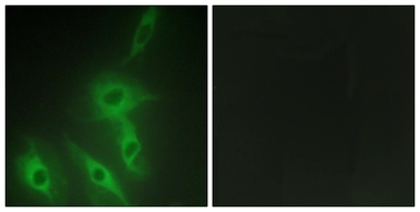 Anti-AS250 antibody used in Immunocytochemistry/ Immunofluorescence (ICC/IF). GTX87983