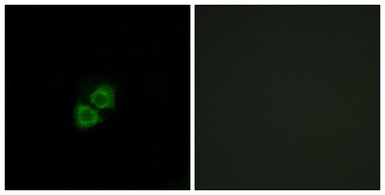Anti-APOA1BP antibody used in Immunocytochemistry/ Immunofluorescence (ICC/IF). GTX87985