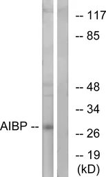 Anti-APOA1BP antibody used in Western Blot (WB). GTX87985