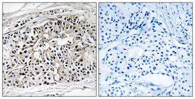 Anti-EHHADH antibody used in IHC (Paraffin sections) (IHC-P). GTX87989