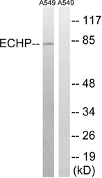 Anti-EHHADH antibody used in Western Blot (WB). GTX87989
