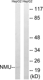 Anti-NMU antibody used in Western Blot (WB). GTX87991