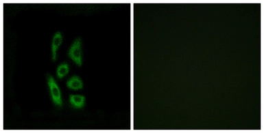 Anti-ACOT12 antibody used in Immunocytochemistry/ Immunofluorescence (ICC/IF). GTX87992