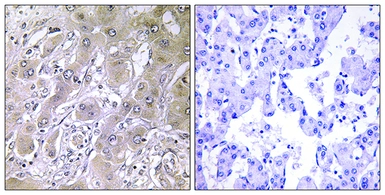 Anti-ACOT12 antibody used in IHC (Paraffin sections) (IHC-P). GTX87992