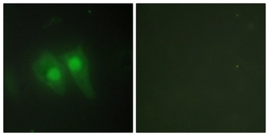 Anti-STEAP3 antibody used in Immunocytochemistry/ Immunofluorescence (ICC/IF). GTX87995