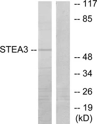 Anti-STEAP3 antibody used in Western Blot (WB). GTX87995