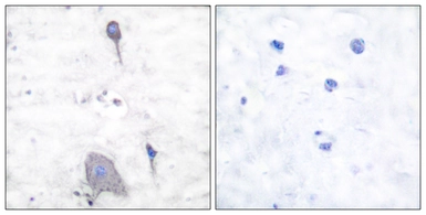 Anti-SIRP alpha antibody used in IHC (Paraffin sections) (IHC-P). GTX87997