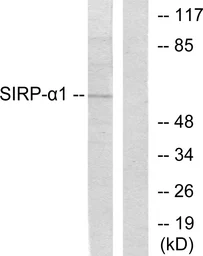 Anti-SIRP alpha antibody used in Western Blot (WB). GTX87997