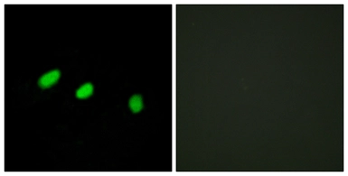 Anti-TRA-2 alpha antibody used in Immunocytochemistry/ Immunofluorescence (ICC/IF). GTX87998