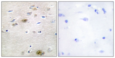 Anti-TRA-2 alpha antibody used in IHC (Paraffin sections) (IHC-P). GTX87998