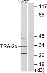 Anti-TRA-2 alpha antibody used in Western Blot (WB). GTX87998