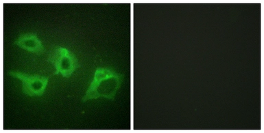 Anti-Casein Kinase 1 alpha antibody used in Immunocytochemistry/ Immunofluorescence (ICC/IF). GTX88000