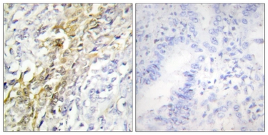 Anti-Casein Kinase 1 alpha antibody used in IHC (Paraffin sections) (IHC-P). GTX88000