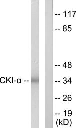 Anti-Casein Kinase 1 alpha antibody used in Western Blot (WB). GTX88000