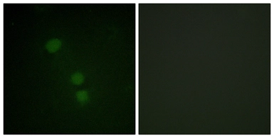 Anti-Histone H2BK15ac (acetyl Lys15) antibody used in Immunocytochemistry/ Immunofluorescence (ICC/IF). GTX88002