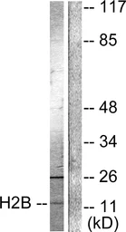 Anti-Histone H2BK15ac (acetyl Lys15) antibody used in Western Blot (WB). GTX88002