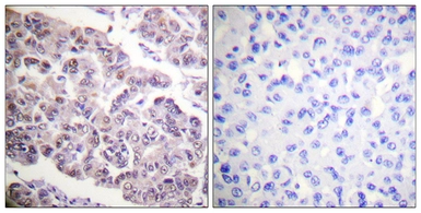 Anti-Histone H4K12ac (acetyl Lys12) antibody used in IHC (Paraffin sections) (IHC-P). GTX88003