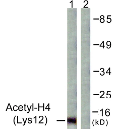 Anti-Histone H4K12ac (acetyl Lys12) antibody used in Western Blot (WB). GTX88003