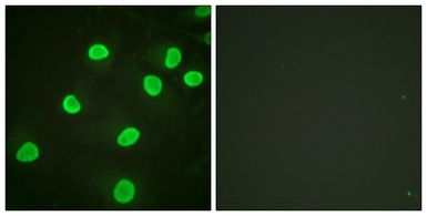 Anti-Histone H4K5ac (acetyl Lys5) antibody used in Immunocytochemistry/ Immunofluorescence (ICC/IF). GTX88005