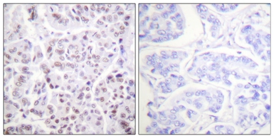 Anti-Histone H4K5ac (acetyl Lys5) antibody used in IHC (Paraffin sections) (IHC-P). GTX88005