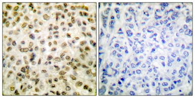 Anti-Histone H1K25ac (acetyl Lys25) antibody used in IHC (Paraffin sections) (IHC-P). GTX88006