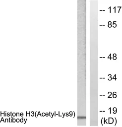Anti-Histone H3K9ac (Acetyl Lys9) antibody used in Western Blot (WB). GTX88007