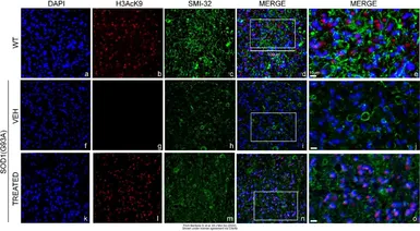 Anti-Histone H3K9ac (Acetyl Lys9) antibody used in IHC (Frozen sections) (IHC-Fr). GTX88007